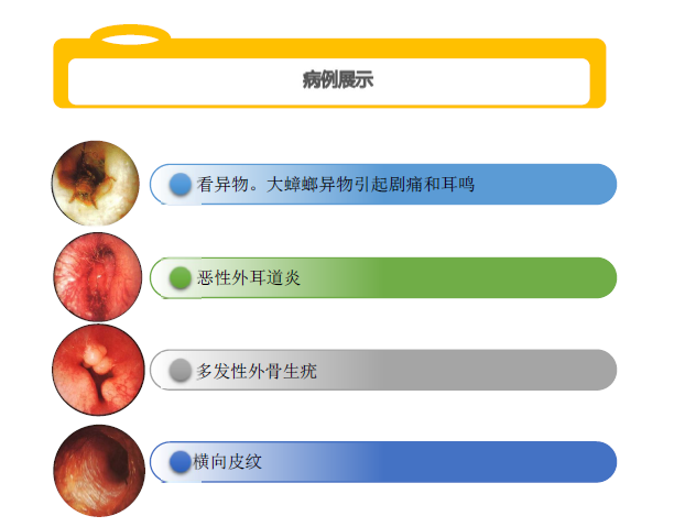 T9316耳鼻醫(yī)療內(nèi)窺鏡